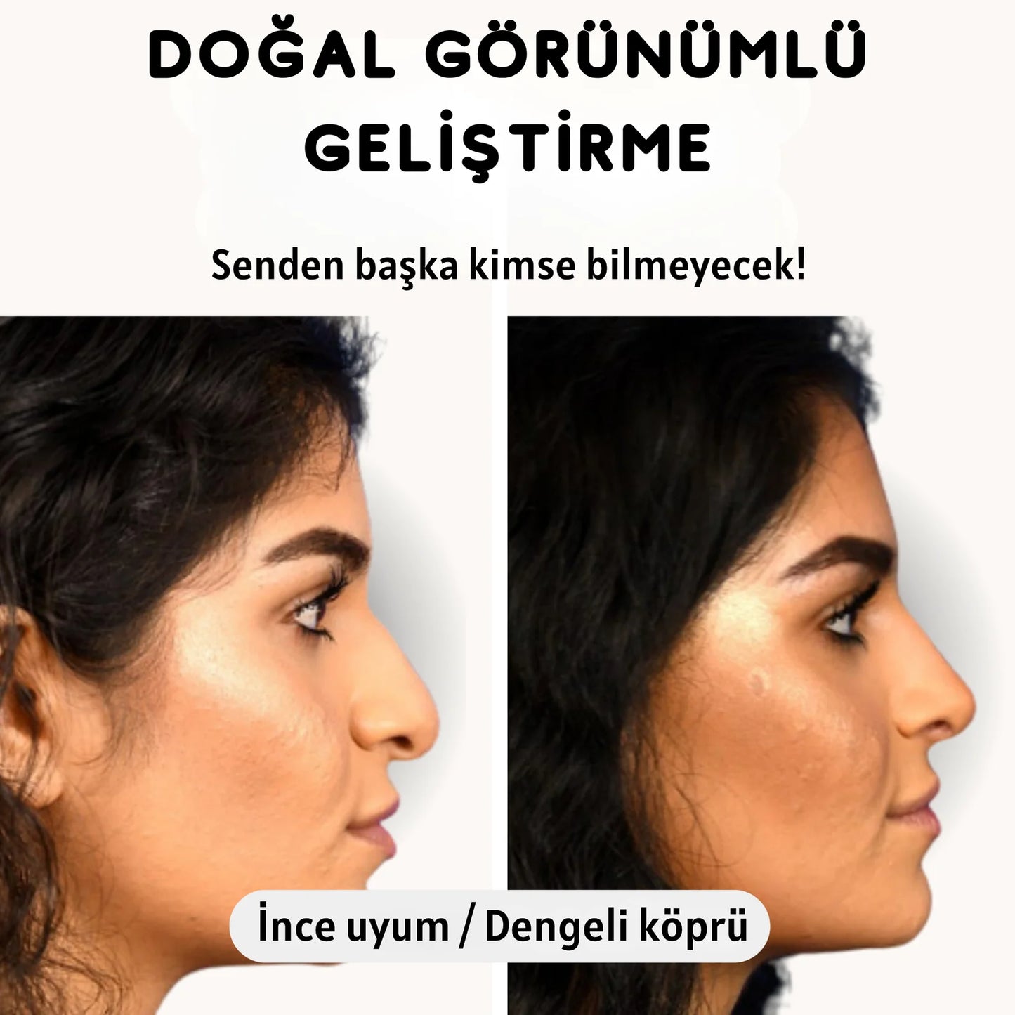 Estetik Mi | Burun Kaldırma Aparatı